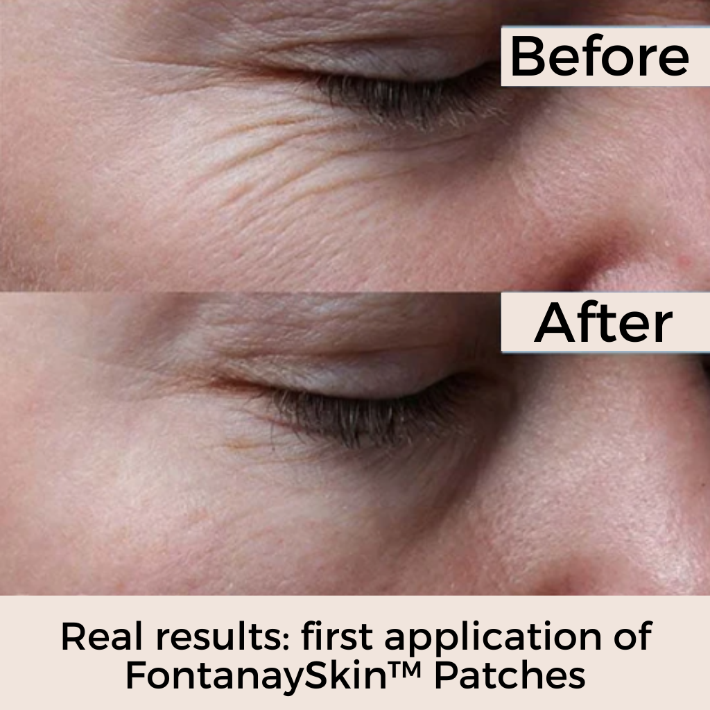 Anti-Wrinkle Reusable Face Patches