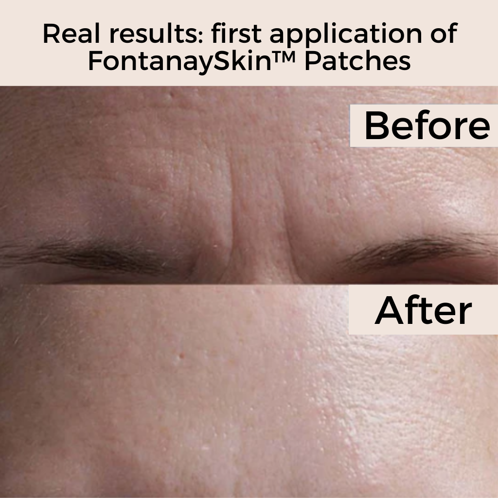 Anti-Wrinkle Reusable Face Patches